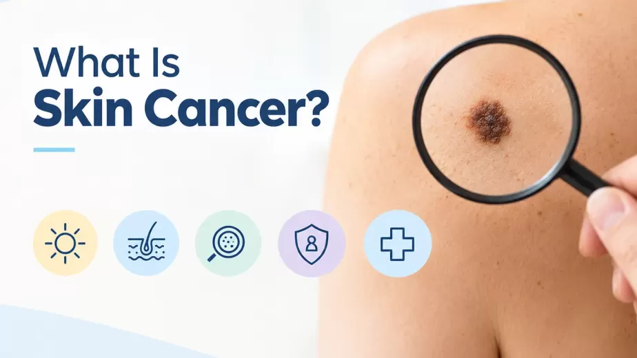 What Is Skin Cancer?